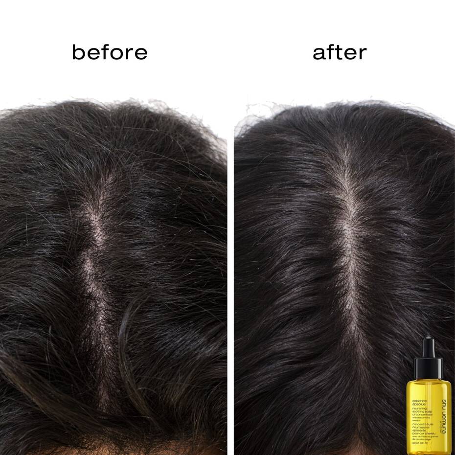 Shu Uemura Essence Absolue Nourishing Soothing Scalp Oil Concentrate – 3
