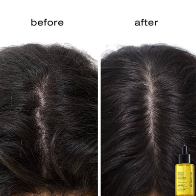 Essence Absolue Nourishing Soothing Scalp Oil Concentrate